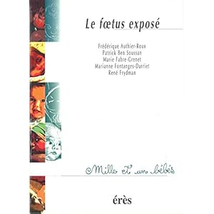 Le foetus exposé - 1001 bb n°18 (Mille et un bébés)