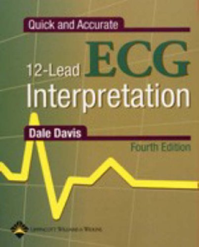 Quick and Accurate 12 Lead ECG Interpretation Quick and Accurate 12 Lead ECG Interpretation