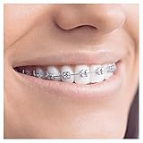 oral b pulsonic slim luxe 4000 Bessere Putzergebnisse mit Echtzeit-Feedback dank Bluetooth-Verbindung und Oral-B App; Lithium-Ionen-Akku hält mit einer Vollladung mehr als 2 Wochen