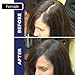 Dark Brown Hair Building Fibers Large 22g Pack Amazing New Concept to Save Money, Fibres For use by Men and Women
