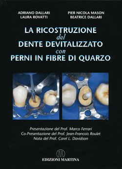 Perni Fibra Quarzo Dentali Pali In Fibra Di Quarzo Per Odontoiatria - Confezione Da 20 Pezzi, Diametri Vari, Per Canali Radicolari Kit 20 Pezzi 1.0-1.6mm - Foto 7