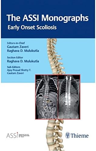 The ASSI Monographs—Early Onset Scoliosis