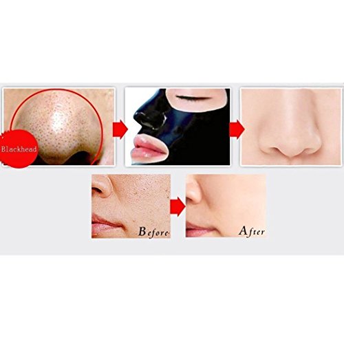 Boolavard Mitesser Entferner Tiefenreinigung Peel Off Akne Black Mask + Pore Streifen - 3