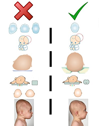 Babykissen für Plagiozephalie | Babykopfkissen gegen Plattkopf | Memory-Schaum-Kissen für Ihr Neugeborenes | Kinderkissen gegen Verformung des Hinterkopfs | Lagerungskissen baby kopf | Kissen für Baby kopfform | 100% GARANTIE und KOSTENLOSE LIEFERUNG - 2