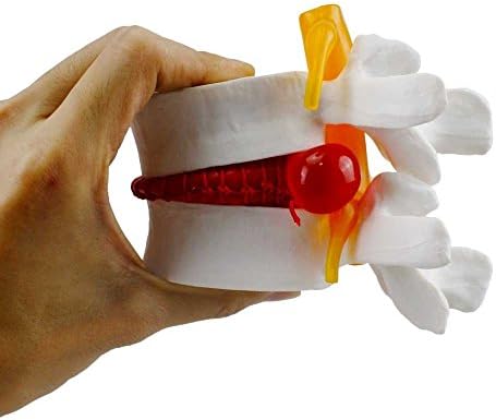 airgoesinHuman Cervical Spinal Cord Vertebral Intervertebral Disc Spine Display Model