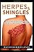 Produktbild HERPES AND SHINGLES: How to Relief The Pain of Herpes zoster ,Treat the Virus and Prevent Future Outbreak