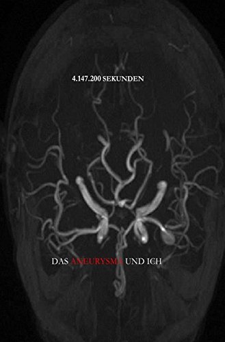 Arteria cerebri media - Lexikon der Neurowissenschaft