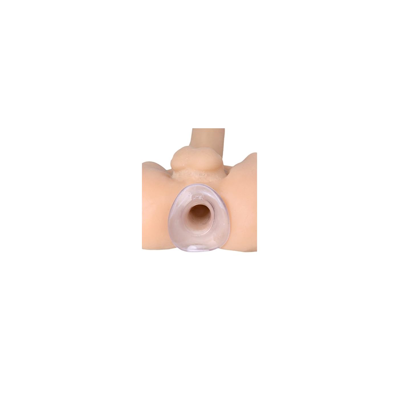 Anus UK