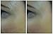 Dermier Collagen Serum 30ml