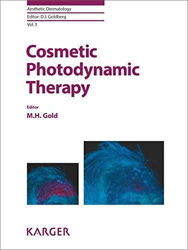 Cosmetic Photodynamic Therapy (Aesthetic Dermatology)