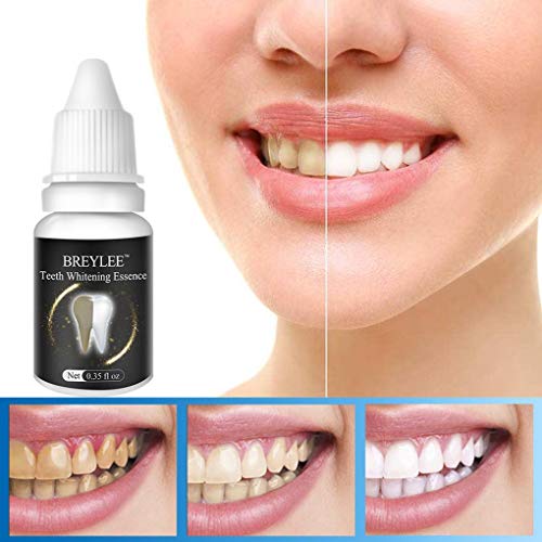 Preisvergleich Produktbild Wokee 10 ML Zahnaufhellung Flüssigkeit, Bleaching, Zahnaufhellung Hygiene Reinigung Zähne Pflege Zahnreinigung Whitening Wasser