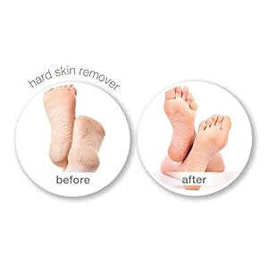 Rio 3-in-1 Lady Shaver Epilator and Pedi Hard Skin Remover - Image 7