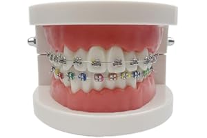 Dental Orthodontic Model, YOUYA DENTAL Demonstration Orthodontic Model Teeth Teach Study Tools with 1/2Metal and 1/2Metal self-Locking Bracket(Red)