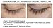 Eyelash Growth Serum - URLASH - The Best 2 in 1 Eyelash Conditioner For Longer Thicker Lashes - Cutting Edge Formula Containing Myristoyl Pentapeptide-17 + Swiss Apple Stem Cell + Tricholastyl. Clinically Proven - 75% Increase In Eyelash Thickness & Length. Works Great On EYEBROWS Too