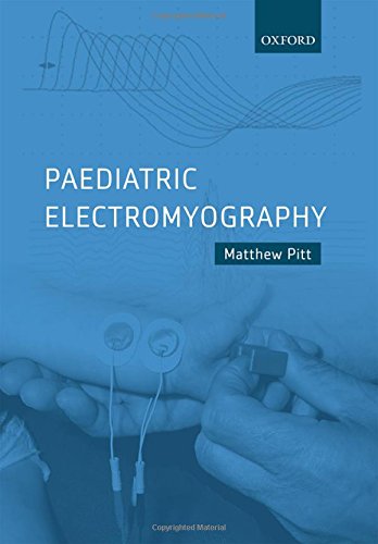 Download Paediatric Electromyography Download Paediatric Electromyography