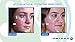 Omiera Labs Facial Hair Inhibitor & Acne Spot Treatment Cream and Cleanser 3Pc Skin Care Set
