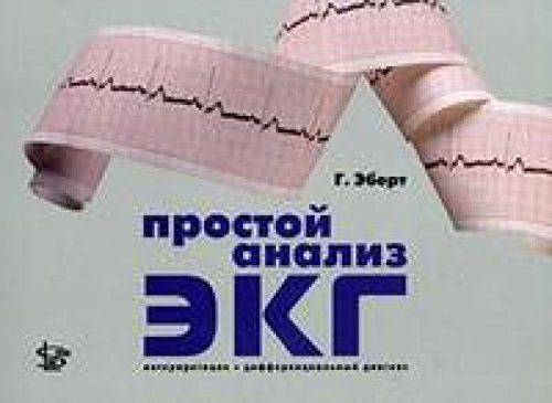 Prostoy analiz EKG. Interpretatsiya, differentsialnyy diagnoz