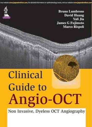 Clinical Guide to Angio-OCT: Non Invasive, Dyeless OCT Angiography livre