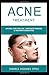 Produktbild ACNE TREATMENT: Natural Cure For Acne , Home Made Remedies & Treatments Medication