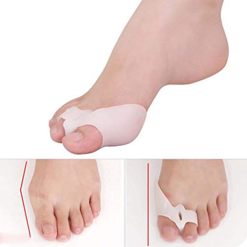 Huayang Silikon Gel Fuß Zwei Zehen Separator Hallux Valgus Korrektor Glätteisen Orthese (weiß) - 3