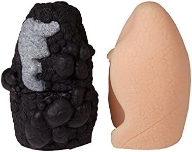 Lung Cancer Test Model with CPR Model Lung Cancer Anatomy Model Set of 2