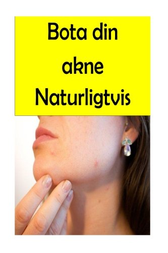 Preisvergleich Produktbild Bota din akne Naturligtvis