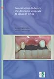 Image de Reconstruccion de dientes endodonciados