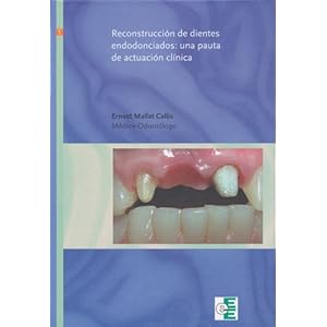 Reconstruccion de dientes endodonciados