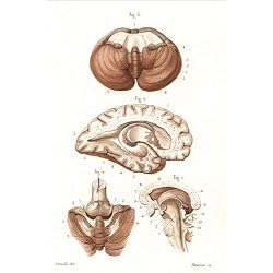 Cuadro sobre lienzo 120 x 180 cm: Sections through the brain, cerebellum and ventricles