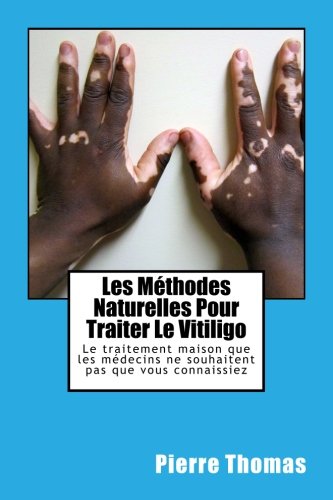 Download Les Méthodes Naturelles Pour Traiter Le Vitiligo: Le traitement maison que les médecins ne souhaitent pas que vous connaissiez Download Les Méthodes Naturelles Pour Traiter Le Vitiligo: Le traitement maison que les médecins ne souhaitent pas que vous connaissiez