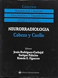 Image de Neurorradiologia: Cabeza Y Cuello (Coleccion diagnostica y terapeutica: radiologia e imagen)