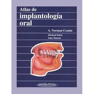 Atlas de implantologia oral
