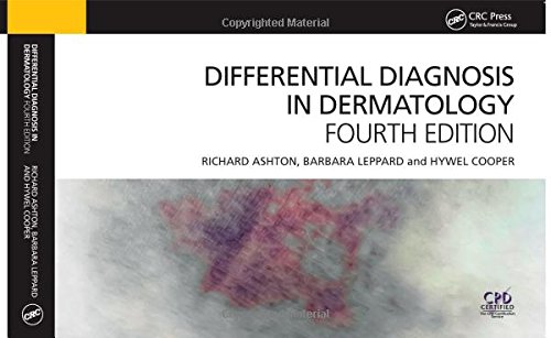 DIFFERENTIAL DIAGNOSIS IN DERMATOLOGY (EX)