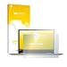 Produktbild upscreen Reflection Shield Displayschutzfolie Lenovo Yoga 720 (13") Schutzfolie Matt – Entspiegelt, Anti-Fingerprint