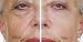 Immaculift Face Lift/ Eye lift Serum 30ml Instant Wrinkle Remover. Turn Back Time! Lasts Up To 8 Hours, Works in Minutes!