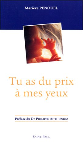 Download Tu as du prix à mes yeux Download Tu as du prix à mes yeux