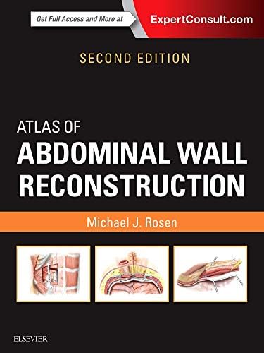 Atlas of Abdominal Wall Reconstruction -2E
