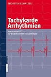 Image de Tachykarde Arrhythmien: Vom Anfalls-EKG zur modernen Differentialtherapie: Vom Anfalls-Ekg