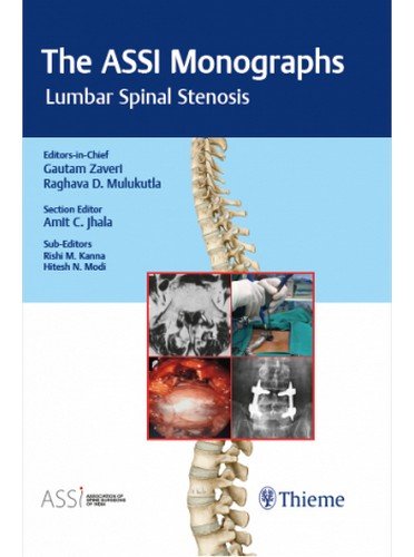 The ASSI Monographs-Lumbar Spinal Stenosis