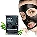 5 x Mineral Mud Nose Pore Cleansing Blackhead Removal Cleaner Membranes Mask