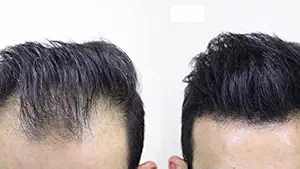 Caboki hair building fiber and concealer Dark Brown 25gms