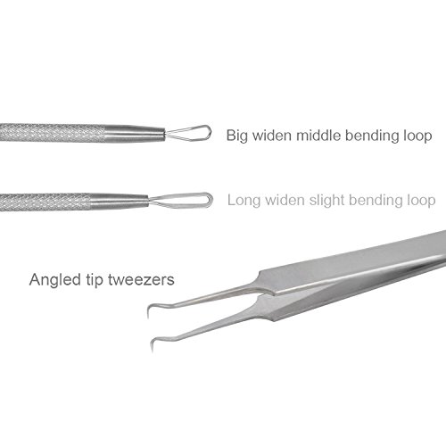 Defoyou 2 Stücke Mitesserentferner – Komedonenquetscher Set aus Edelstahl – Nagelhautschieber Werkzeug Pickel Whiteheads Akne Extraktoren für Gesundheit Behandlung - 4