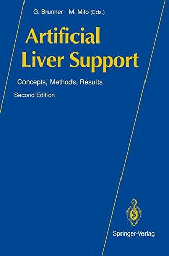 Artificial Liver Support: Concepts, Methods, Results