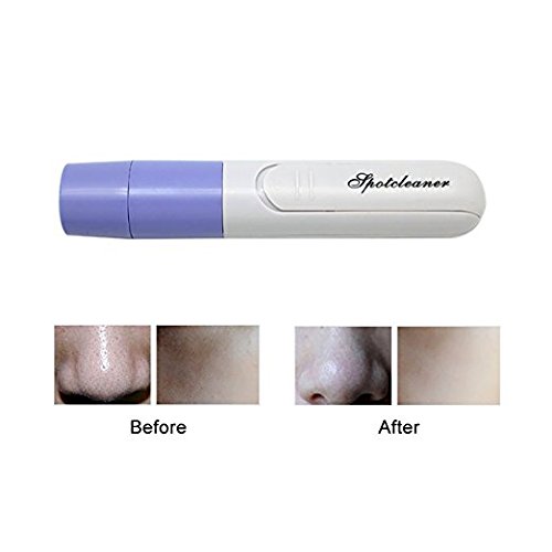 Pore Cleanser, Stoga Portable Facial Pore Cleaner Blackhead Akne Remover Werkzeuge Kit Pore Extractor Tool- Gesicht Reinigung Kit Zubehör - 4