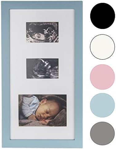 Precious Prints Double Baby Ultrasound Scan &amp; Photo Picture Frame - Available in a range of Colours