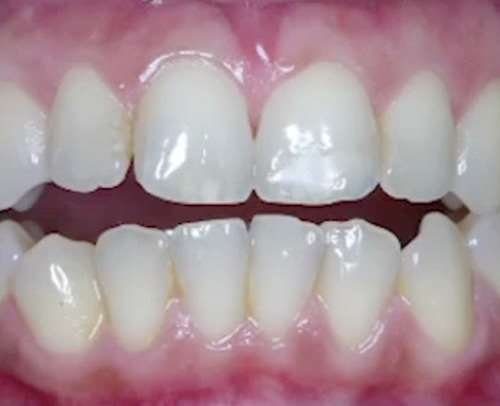 Preisvergleich Produktbild Unusual TMD Cases - Unusual Treatment