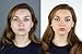 Bare Face Minerals Full Coverage Mineral Foundation | Long Lasting | Oil Free Loose Powder Foundation | Rosacea Burns Freckles Acne Makeup Solutions | 8g NET (Soft-Beige)