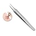 Price comparison product image Huayang| Stainless Steel Bend Blackhead, Comedone Remover Clip Needle Straight Tweezer for Blackheads/ Comedone/ Acne Blemish Extractor Kit- (Hook head, Curved head, Straight head)