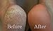 BEST RATED Baby Foot Peel Pedicure Mask by Grace & Stella® - Odor Eliminator & Callus Remover - 100% Satisfaction Guarantee - Do It Yourself At Home Moisturizing Cuticle Soaks Socks (UK Seller) (1 Pair (£9.95/pc), Lavender)