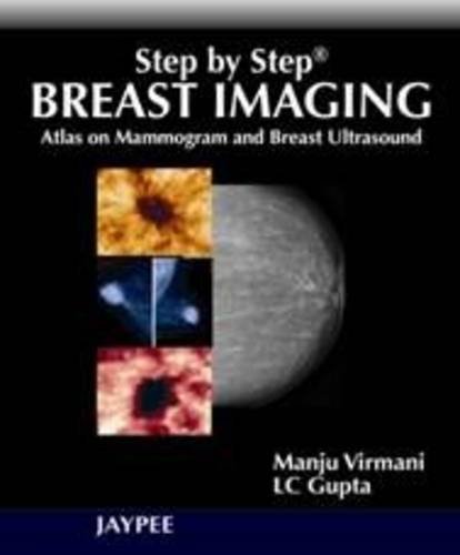 Preisvergleich Produktbild Step by Step Breast Imaging